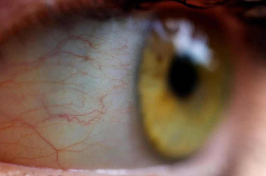 A closeup of human eye Courtesy - The Independent